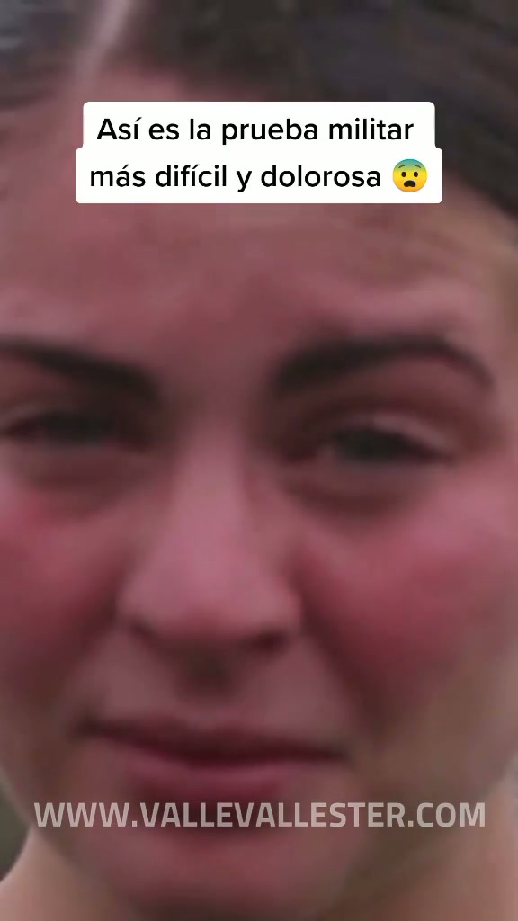 algunos lo describen como la sensacion mas dolorosa y otros la describen como ci 1